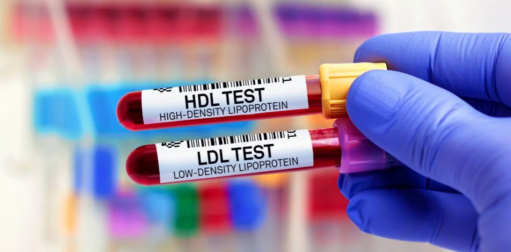 Nowe wytyczne dotyczące cholesterolu. Leczenie może rozpocząć się wcześniej, niż dotychczas sądzono