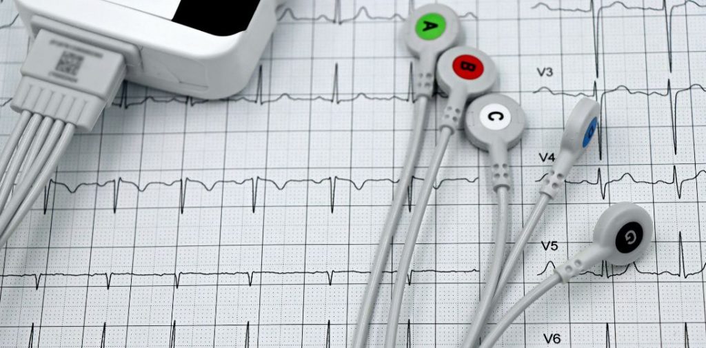 Godziny zapisu EKG na jednej kolorowej mapie. Naukowcy z Politechniki Warszawskiej opracowali nową metodę analizy pracy serca